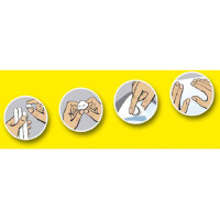 UHU Klebepads patafix, wieder ablösbar, gelb